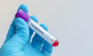 Rękawiczka w niebieskiej rękawiczce trzyma probówkę z oznaczeniem "Toxoplasma", z zaznaczonym wynikiem dodatnim. Badanie na toksoplazmozę objawy.