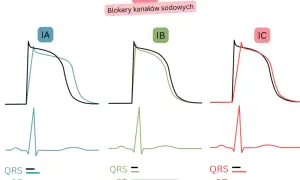 Wykresy potencjałów czynnościowych komór serca dla bloków klasy I (IA, IB, IC), porównujące działanie leków, np. amiodaronu, z kontrolą.