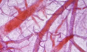 Mikroskopowa angiografia ukazuje sieć naczyń krwionośnych w kolorze czerwonym na fioletowym tle.