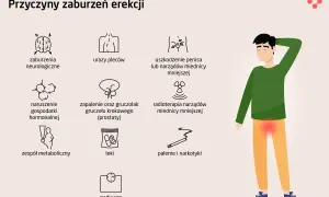 Ilustracja przedstawia przyczyny zaburzeń erekcji, w tym problemy neurologiczne, hormonalne, urazy, choroby prostaty, leki, palenie, nadwagę i inne.