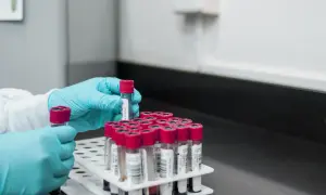 Ręce w niebieskich rękawiczkach pobierają próbki do analizy. W tle stojak z wieloma probówkami, gotowymi do badań, być może do analizy jonogramu.