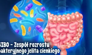 Grafika przedstawia jelita i bakterie, ilustrując problem SIBO. Objawy mogą być uciążliwe.