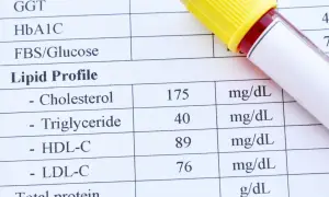 Wynik lipidogramu: trójglicerydy 40 mg/dL, co mieści się w normie. Obok probówka z krwią.