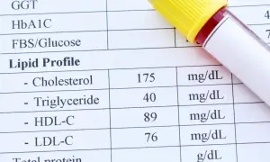Wynik lipidogramu z próbką krwi. Wyniki wskazują na dyslipidemię, wymagającą dalszej diagnostyki.