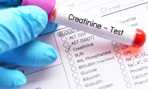 Rękawiczka w niebieskiej rękawicy trzyma probówkę z napisem "Creatinine - Test". Zaznaczono pole "Creatinine" na formularzu badań.