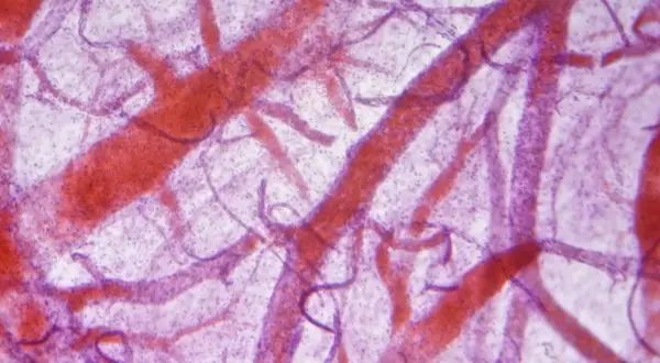 Mikroskopowa angiografia ukazuje sieć naczyń krwionośnych w kolorze czerwonym na fioletowym tle.