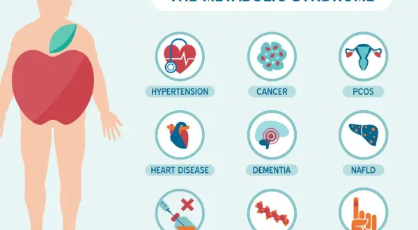 Ilustracja przedstawia zespół metaboliczny i jego powiązane schorzenia: nadciśnienie, choroby serca, oporność na insulinę, raka, demencję, problemy z lipidami, PCOS, NAFLD i cukrzycę typu 2.