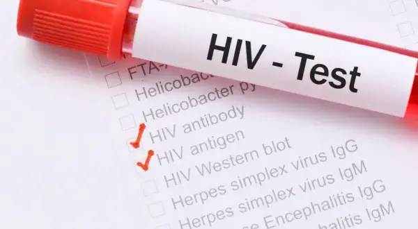 Próbówka z krwią do testu HIV. Zaznaczone "HIV antibody" i "HIV antigen". Wczesne wykrycie objawów HIV jest kluczowe.
