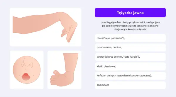 Tężyczka jawna: ilustracje przedstawiające rękę w pozycji "położnika", twarz z wykrzywionymi ustami i stopę.