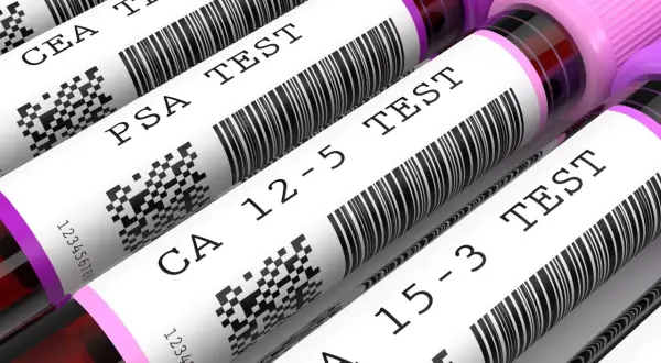 Rurki z próbkami krwi z etykietami: CEA TEST, PSA TEST, CA 12-5 TEST, CA 15-3 TEST.