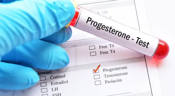 Rękawiczka w niebieskiej rękawiczce trzyma probówkę z napisem "Progesterone - Test". Zaznaczono pole "Progesterone" na formularzu.