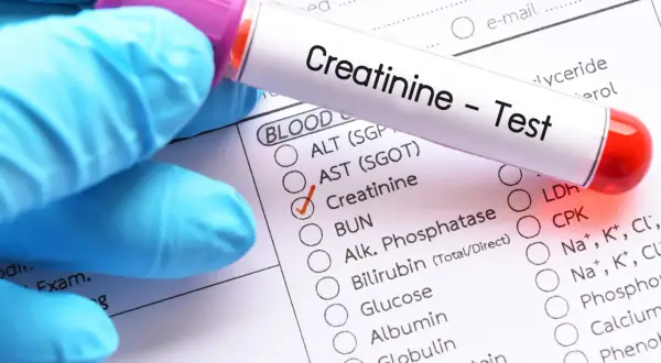 Rękawiczka w niebieskiej rękawicy trzyma probówkę z napisem "Creatinine - Test". Zaznaczono pole "Creatinine", sugerując niską kreatyninę.