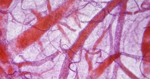 Mikroskopowa angiografia ukazuje sieć naczyń krwionośnych w kolorze czerwonym na fioletowym tle.