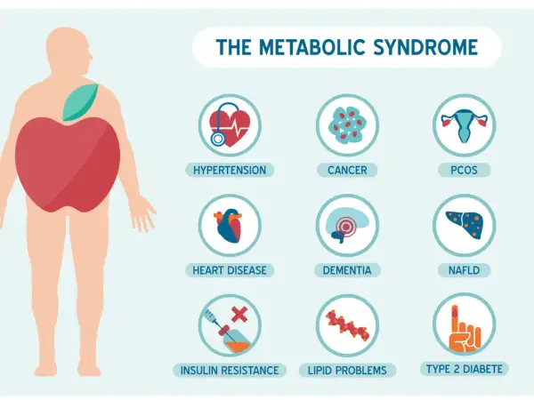Ilustracja przedstawia zespół metaboliczny i jego powiązane schorzenia: nadciśnienie, choroby serca, oporność na insulinę, raka, demencję, problemy z lipidami, PCOS, NAFLD i cukrzycę typu 2.