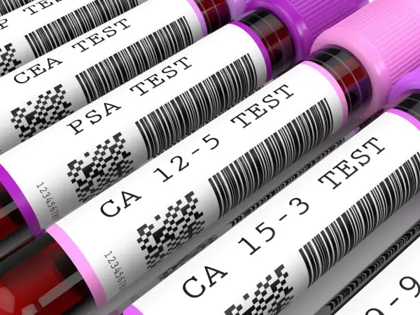 Rurki z próbkami krwi z etykietami: CEA TEST, PSA TEST, CA 12-5 TEST, CA 15-3 TEST.