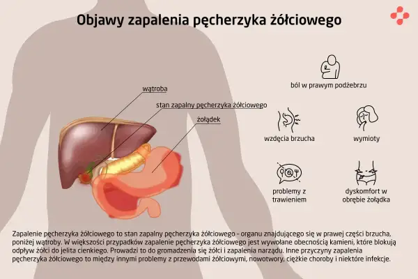 Ilustracja anatomiczna przedstawiająca wątrobę, pęcherzyk żółciowy i żołądek z objawami zapalenia.