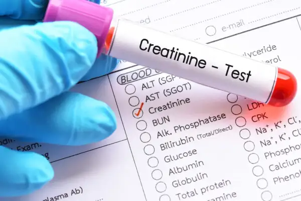 Rękawiczka w niebieskiej rękawicy trzyma probówkę z napisem "Creatinine - Test". Zaznaczono pole "Creatinine", sugerując niską kreatyninę.