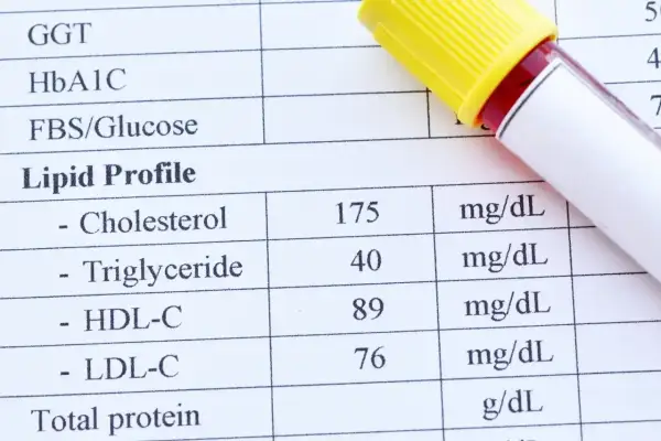 Wynik lipidogramu z próbką krwi. Wyniki wskazują na dyslipidemię, wymagającą dalszej diagnostyki.