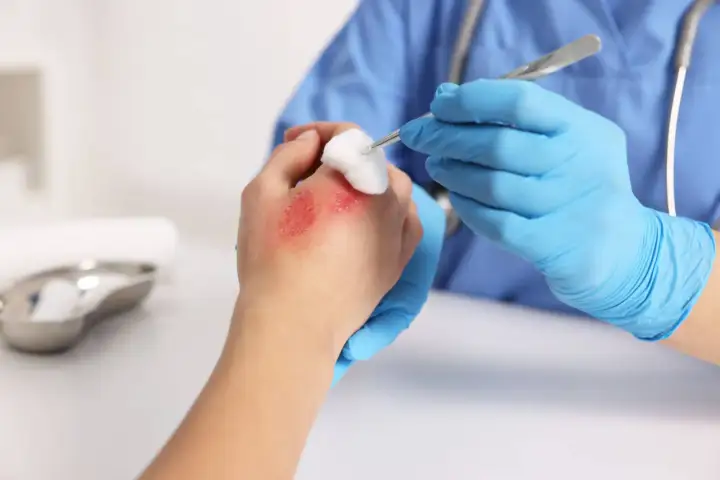 Kodan do dezynfekcji skóry - jak stosować i na co uważać